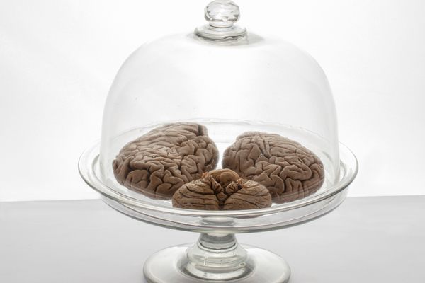 The neuroscientist’s brain is brownish and small, but is otherwise virtually unchanged from the 1800s.