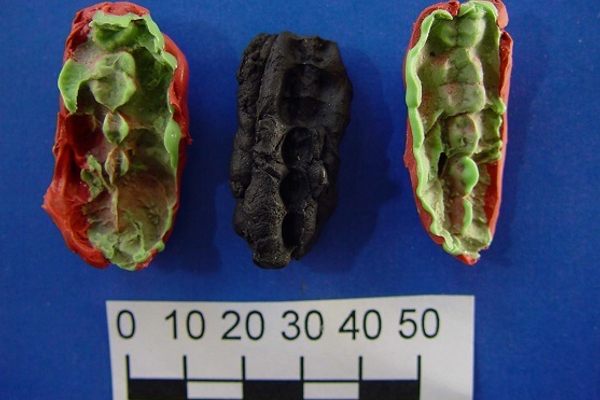 Using teeth as tools likely led to early tooth decay.